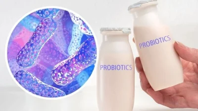 Mengenal Apa Itu Probiotik dan Daftar Makanan untuk Kesehatan Usus