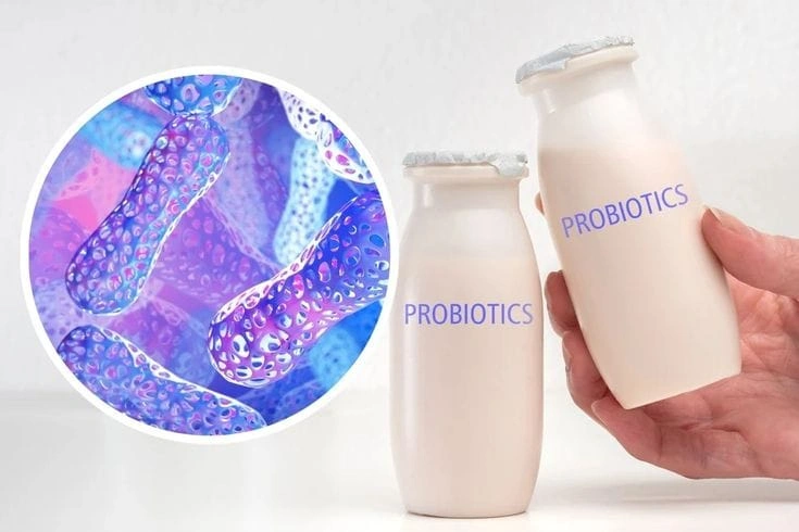 Mengenal Apa Itu Probiotik dan Daftar Makanan untuk Kesehatan Usus