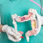 Mitos atau Fakta? Makan Biji Jambu Biji Bikin Usus Buntu?