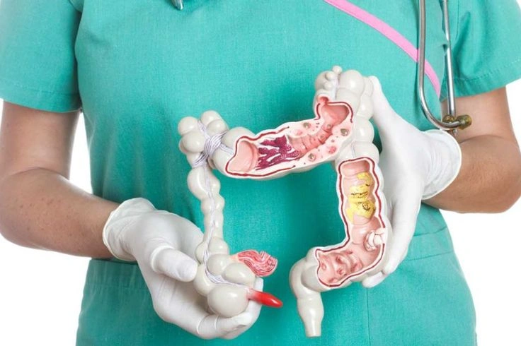 Mitos atau Fakta? Makan Biji Jambu Biji Bikin Usus Buntu?